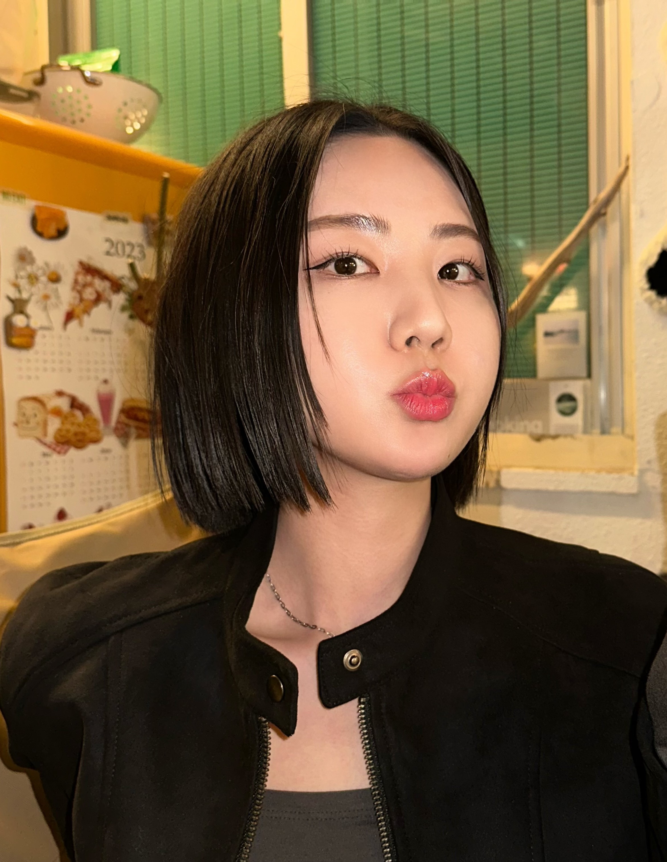 눈밑지방재배치 후기