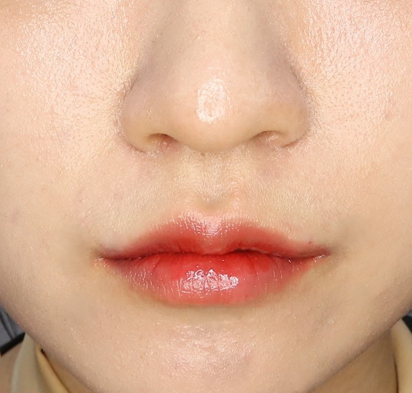 러시안립필러 후기